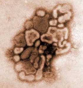 H1N1 influenza